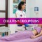 Celulitis y criolipólisis